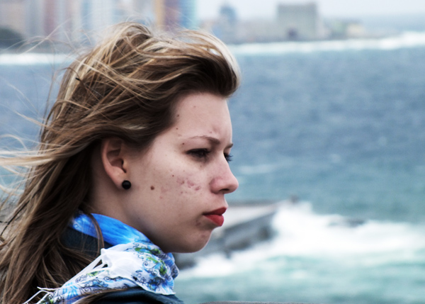 Secretos para mejorar el acné. Foto: Abel Rojas Barallobre Secretos para mejorar el acné. Foto: Abel Rojas Barallobre