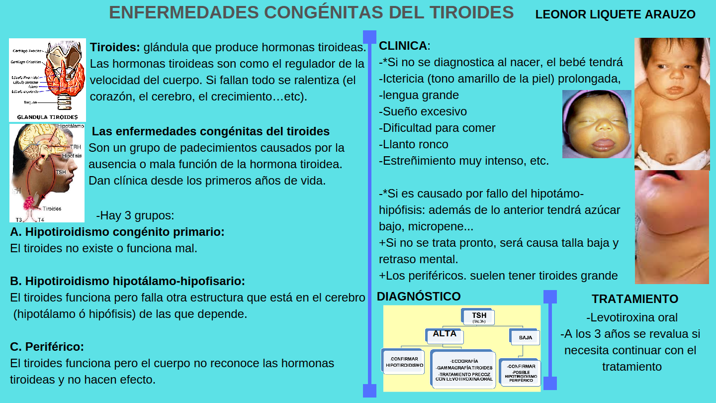 Cuba Con Programa Consolidado En Pesquisa De Hipotiroidismo Cong Nito Radio Rebelde